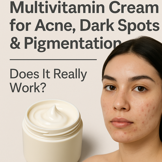 Multivitamin Cream for Acne, Dark Spots & Pigmentation: Does It Really Work?